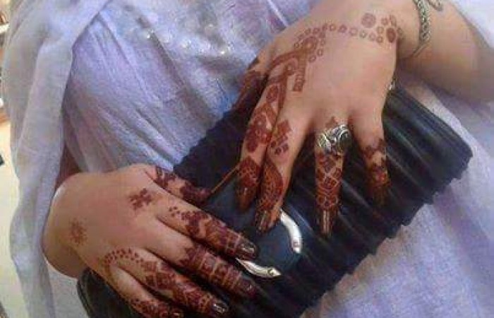 للنساء/ التحذير من تناول دواء يتسبب في تشوه&nbsp;الأجنة